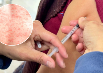 Casos De Sarampión - Salud Regia