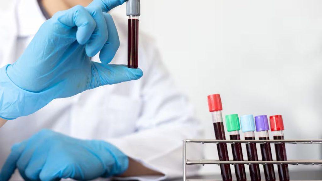 Cifras De Niños Con Plomo En La Sangre Aumentan 