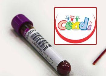 Sube Cifra De Menores Con Plomo En La Sangre - Salud Regia